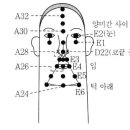 피부에 발진이 생기는 대상포진 이미지