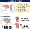 1분1초가 중요한 뇌졸중…골든타임 놓치지 마세요 이미지