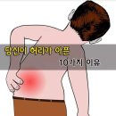 당신이 허리가아픈 10가지이유 이미지