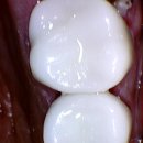 화이트디지털치과기공소 이미지