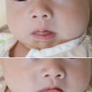 쁘띠하개 | 신생아태열 관리엔 어네이브 세럼! 일주일 실사용 후기 리뷰