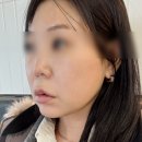 제닉스바이오 | 저속노화앰플추천 줄기세포앰플 줄기세포화장품 엑소제닉스 앰플