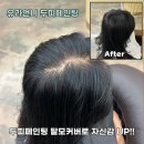 번40 | 두피컬러링 점점 넓어지는 가르마 고민 한번에 해결 40대 여성 후기