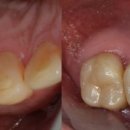 정석치과기공소 이미지