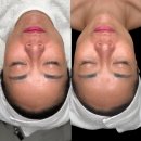 왕십리길약국 | 왕십리에스테틱 뤼에르스킨 슈퍼젝션 재생관리로 물광피부 찾기