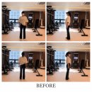 김포재활운동PT 코어운동재활센터 고관절 인공수술 재활운동 관리