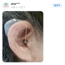 대동 독일보청기 이미지