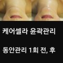 케어셀라 이미지