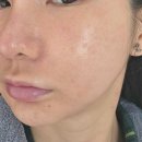 하이퍼들 | &lt;메디힐&gt; 하이퍼 콜라겐 마스크 기획세트 솔직 후기 (feat. 무보정)