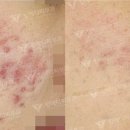 탑메디케어 이미지