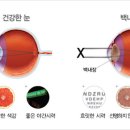 비타민안경.콘택트 이미지