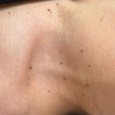 다이아에스테틱 이미지