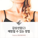 갑상선암(2)- 예방할 수 있는 방법 이미지