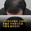 리게인프로젝트 - 남구 돋질로377번길 4 | 대구정수리탈모 고생하던 분들은 두피문신으로 이렇게 달라진다? 리게인프로젝트 후기와 효과