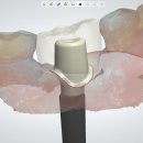R - Dental 티스토리