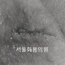 서울화봄의원 네이버블로그