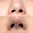 예술회관역 | 구월동 예술회관역 하이코프팅 내돈내산 후기