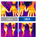 통증으로 힘드신가요? 아셀케어 초음파마사지기로...안가고 홈케어로 해보세요 [무릎 마사지 사용 후기]