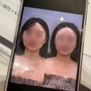 파주힐스테이트 1차 113동 앞 | 운정피부관리 고온에스테틱 3V윤곽테라피 솔직 후기