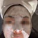 강서톡스앤필의원 | #강서톡스앤필피부과#시그니처톤업#기미주근깨제거#10주시술후기#