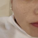 동두천 에스테틱 잡티관리 블랑미토탈뷰티