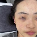 이로 | 오산피부관리샵 이로에스테틱 여드름관리 후기✨