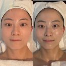 석포로 | 용호동 피부관리 블리스뷰티연구소 파메스테틱 세멘시트 후기