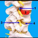 요추간판탈출증(허리디스크) 이미지