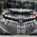 죽파치과의원 이미지