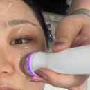 사상에스테틱 루니움 베이비플래닝 후기