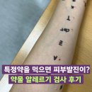 약진약국 | 약만 먹으면 피부에 발진이? &#39;고정약진&#39; 끝에 찾은 원인! 세브란스 병원 약물 알레르기 검사 후기