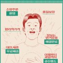 25번청과