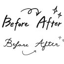 가암염원석성형외과의원 | 성형후기사진의 유의점