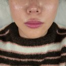 코리아엔제이 | 제이라인코리아 토탈뷰티 울트라리프 100샷 후기