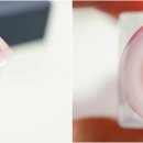 트레졸리 이미지