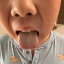 본죽 수서점 | 어린이 편도 수술후 회복기와 음식