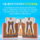 서울J플란트치과의원 네이버블로그