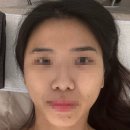 수지 예신관리 상현동 피부샵 추천 윤곽관리 에스티아뷰티 후기