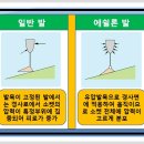 소망의수족보조기 이미지