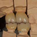 민치아치과기공소 이미지