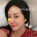 (주)아프리카티비 | 랄랄, 눈밑·코 성형 성공적 새 얼굴 공개 이명화는 어디 갔나