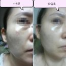 🔺여름시작과 끝물 피부관리🔺매직앤콜라겐으로 홈케어 피부관리🔺연예인 시크릿 뷰티아이탬