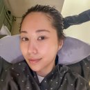 대구 동성로 두피관리 스케일링 웰킨두피탈모센터 동성로점 탈모관리법 후기