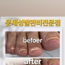 레푸스전주 이미지