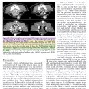 Prostatic carcinoma 개들에서 prostatic artery embolization(PAE) 시술과정 및 단기 예후 이미지