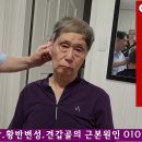 녹내장.황반변성은 이명(耳鳴)과 불면증과 목어깨의 통증을 잡아야 한다. 이미지