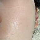 아이스닥터 | 여름철 피부관리 닥터포유 시카엑소좀 아이스 앰플 마스크 사용후기
