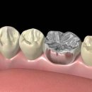이미지 치과기공소 이미지