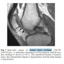 Re : 연골(cartilage)의 조직구성, 분류, 기능, 손상의 회복에 대하여 이미지