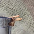 365열린치과의원 | 천안 두정동/성정동 손가락 봉합 수술(꿰맨)후기 | 365열린메디컬의원